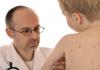 血液検査における子供の免疫グロブリン E の増加と減少：これは何を意味し、標準は何ですか?