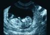 Ultraskaņa grūtniecības laikā: kad un cik reizes to darīt