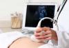 妊娠中の2回目の超音波検査はいつ行われますか?
