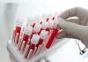 Test sanguin pour l'ancologie : résultats des analyses générales et biochimiques