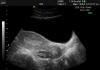 A kismedencei szervek ultrahangja